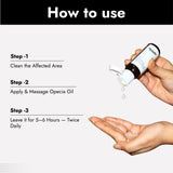 Alopecia Hair Patch Oil with Roller - Advanced Formula for Alopecia Areata Treatment