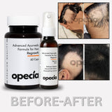Alopecia Areata Treatment Kit | Hair Regrowth Capsules (60 Caps) + Alopecia Serum Spray 50ml