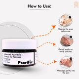 Ayurvedic Natural Cream for Psoriasis & itching (for Night Use)