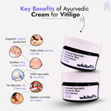 Ayurvedic Herbal Cream for Skin White Patches (Vitiligo) - for Night Use
