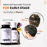 Alopecia Areata Treatment Medicine Kit – Best Natural Solution for Hair Patch, Hair Regrowth & Scalp Nourishment