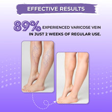 Ayurvedic Oil for Varicose Vein | 100% Natural & Safe