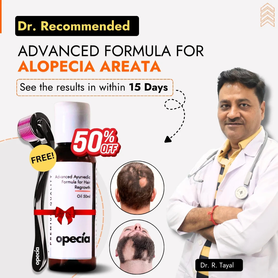 Alopecia Oil Hair Patch Solution for Bald Patches - 100% Natural Treatment