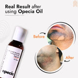 Alopecia Oil Hair Patch Solution for Bald Patches - 100% Natural Treatment
