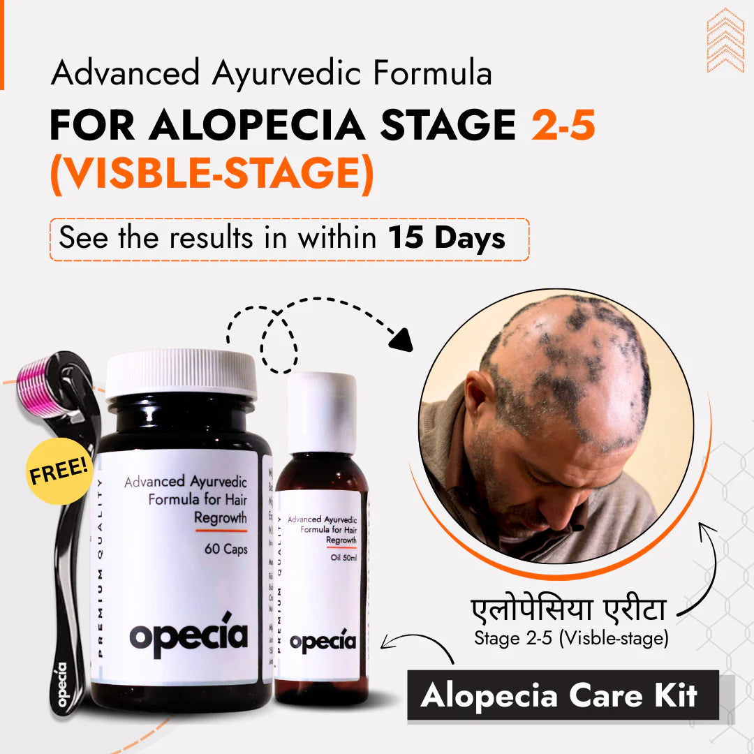 Alopecia Oil Hair Patch Solution for Bald Patches - 100% Natural Treatment