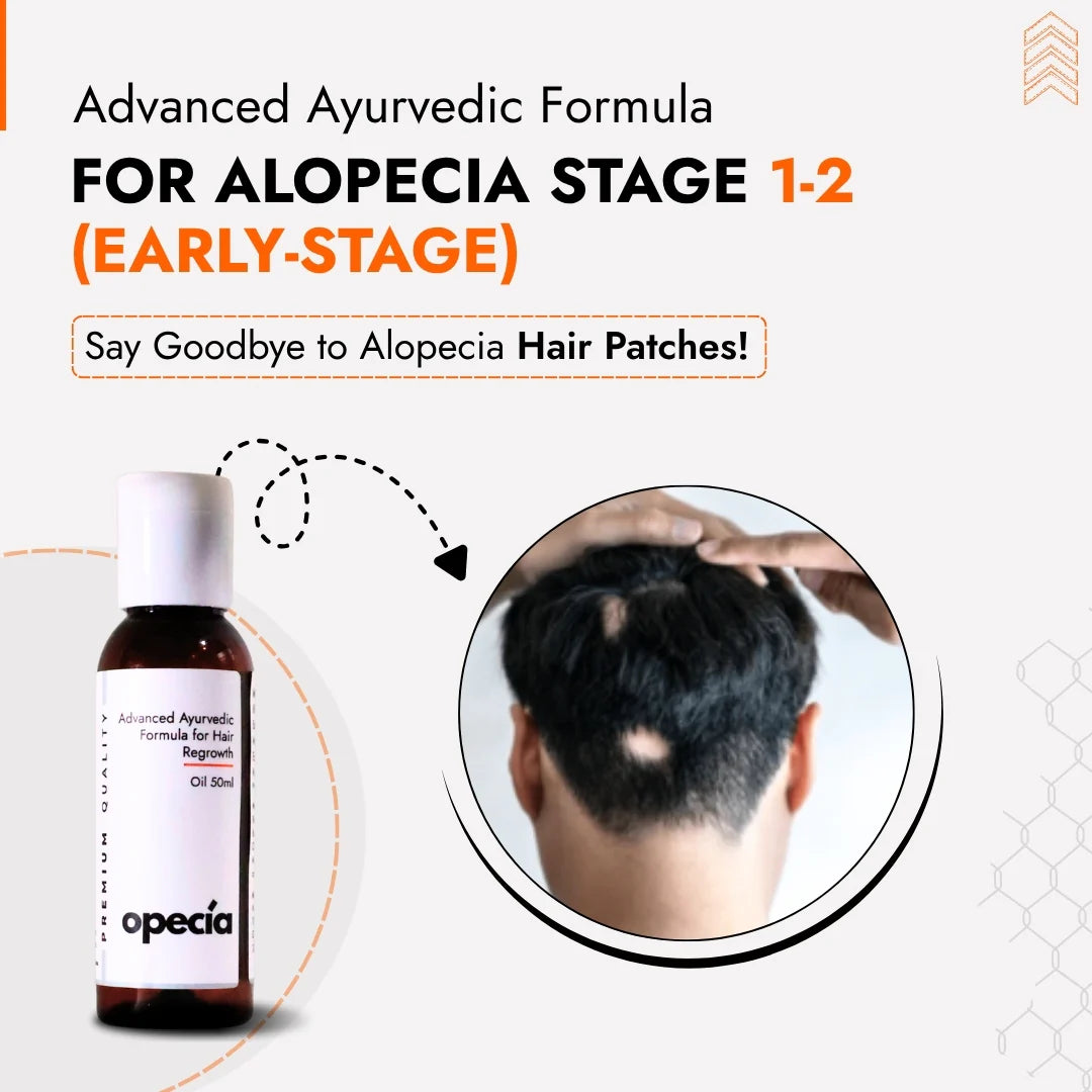 Alopecia Oil Hair Patch Solution for Bald Patches - 100% Natural Treatment