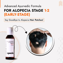 Alopecia Oil Hair Patch Solution for Bald Patches - 100% Natural Treatment