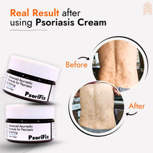 Ayurvedic Natural Cream for Psoriasis & itching (for Night Use)