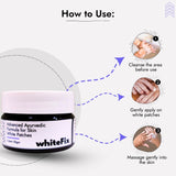 Ayurvedic Herbal Cream for Skin White Patches (Vitiligo) - for Night Use