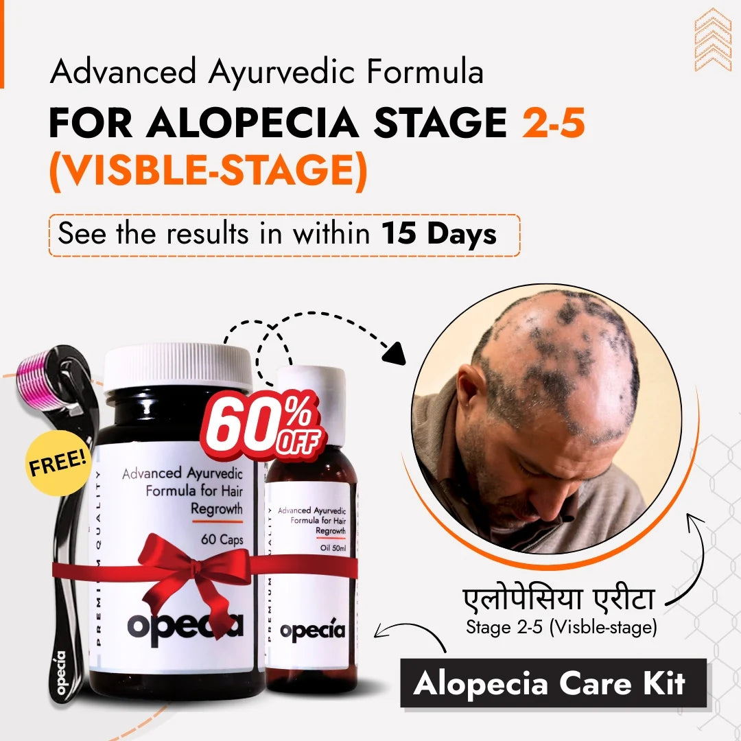 Alopecia Oil Hair Patch Solution for Bald Patches - 100% Natural Treatment