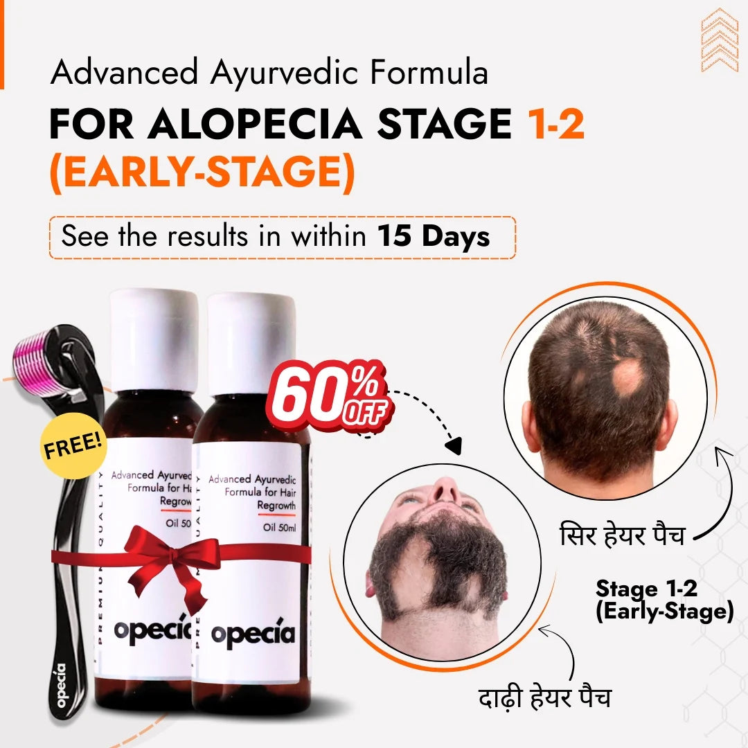 Alopecia Oil Hair Patch Solution for Bald Patches - 100% Natural Treatment