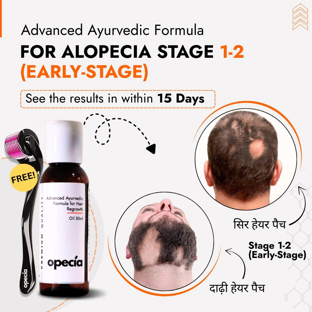 Alopecia Oil Hair Patch Solution for Bald Patches - 100% Natural Treatment