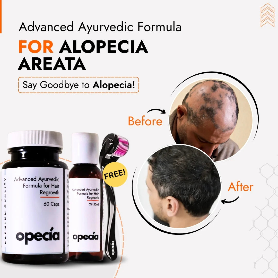 Alopecia Oil Hair Patch Solution for Bald Patches - 100% Natural Treatment